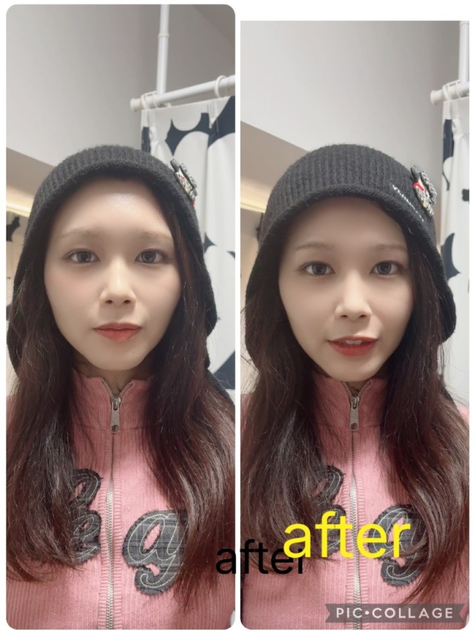 おたすけハドウクリーム✨さゆりちゃん体験談❤️