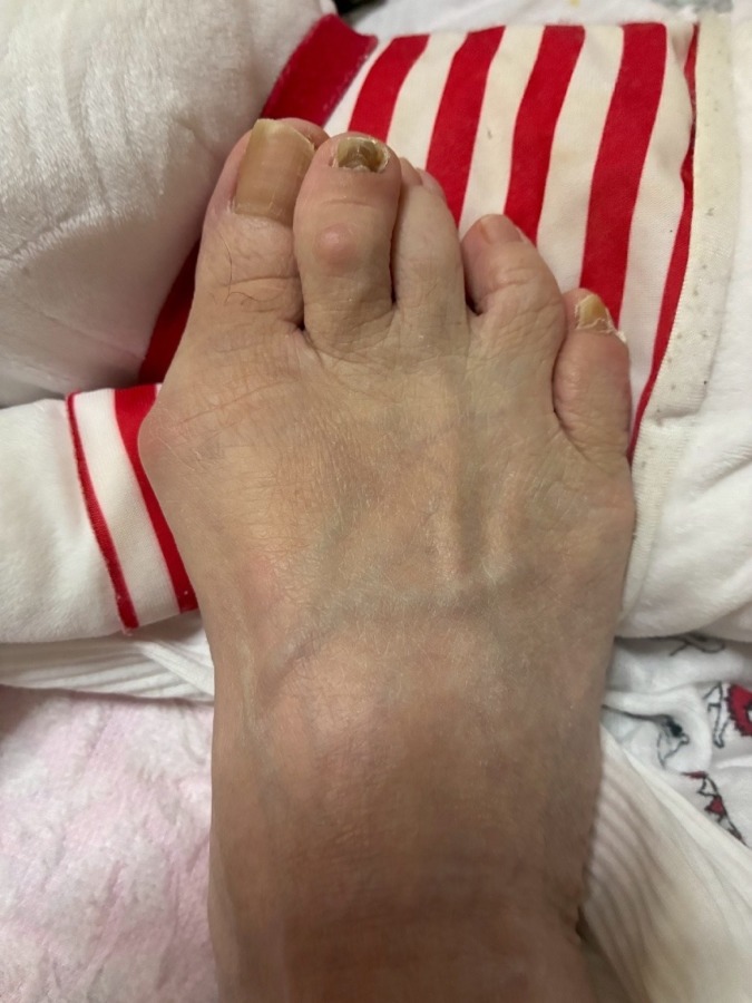 おたすけハドウクリーム体験談